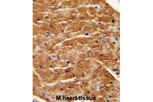 FGF7 antibody (Center) immunohistochemistry analysis in formalin fixed and paraffin embedded human M. (FGF7 Antikörper  (Middle Region))