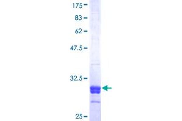 SRD5A2 Protein (AA 28-65) (GST tag)