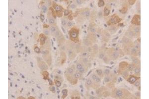 Detection of NEU in Human Liver Tissue using Polyclonal Antibody to Neuraminidase (NEU)