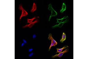 ABIN6265362 and ABIN6272951 staining Hela cells by IF/ICC. (SUCLA2 Antikörper  (Internal Region))