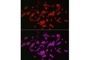 Immunofluorescence analysis of SH-SY5Y cells using G Rabbit pAb (ABIN6127469, ABIN6140954, ABIN6140955 and ABIN6221997) at dilution of 1:25 (40x lens). (GAP43 Antikörper  (AA 1-238))