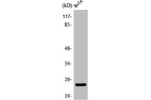 Western Blot analysis of COLO205 cells using PPP1R14D Polyclonal Antibody (PPP1R14D Antikörper  (Internal Region))