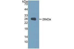 Detection of Recombinant PGM1, Human using Polyclonal Antibody to Phosphoglucomutase 1 (PGM1) (Phosphoglucomutase 1 Antikörper  (AA 1-235))