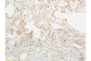 Formalin-fixed and paraffin embedded mouse uterus tissue labeled with Anti-ABP/SHBG Polyclonal Antibody, Unconjugated  at 1:200 followed by conjugation to the secondary antibody and DAB staining (SHBG Antikörper  (AA 51-150))