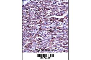 MMP15 Antibody immunohistochemistry analysis in formalin fixed and paraffin embedded human heart tissue followed by peroxidase conjugation of the secondary antibody and DAB staining. (MMP15 Antikörper  (N-Term))