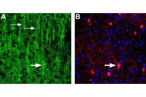 Expression of Nicotinic acetylcholine receptor α3 in rat neocortexImmunohistochemical staining of immersion-fixed, free floating rat brain frozen sections were stained using Anti-Nicotinic Acetylcholine Receptor α3 (CHRNA3) (extracellular) Antibody (ABIN7581853), (1:200).