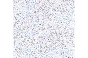 Immunohistochemistry (IHC) image for anti-RNA Binding Motif Protein 9 (RBM9) (AA 1-50) antibody (ABIN7454009)