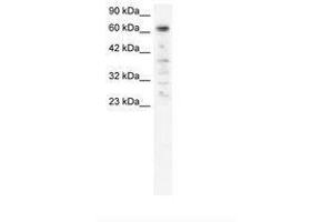 Image no. 2 for anti-Poly (ADP-Ribose) Polymerase Family, Member 3 (PARP3) (AA 446-495) antibody (ABIN6735808)