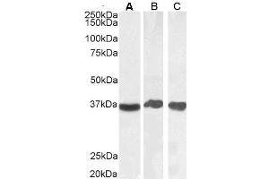 ABIN185543 (0. (GAPDH Antikörper  (Internal Region))