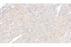 Detection of FOXO3 in Human Cardiac Muscle Tissue using Polyclonal Antibody to Forkhead Box Protein O3 (FOXO3) (FOXO3 Antikörper  (AA 369-633))