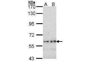 WB Image Sample (30 ug of whole cell lysate) A: A431 , B: H1299 7. (FYN Antikörper  (Center))