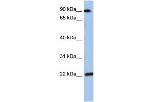 WB Suggested Anti-TMED10 Antibody Titration: 0. (TMED10 Antikörper  (Middle Region))