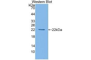Detection of Recombinant HDAC4, Mouse using Polyclonal Antibody to Histone Deacetylase 4 (HDAC4)