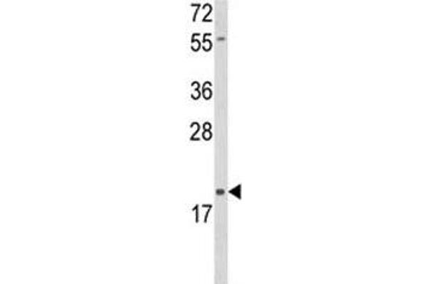DLK2 Antikörper  (AA 353-380)