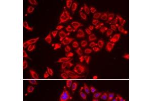 Immunofluorescence analysis of HeLa cells using ST3GAL3 Polyclonal Antibody (ST3GAL3 Antikörper)