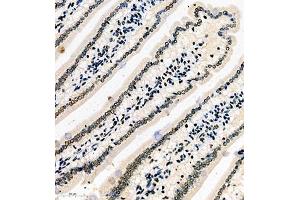 Immunohistochemistry (Paraffin-embedded Sections) (IHC (p)) image for anti-Serine/arginine Repetitive Matrix 2 (SRRM2) antibody (ABIN7075555)