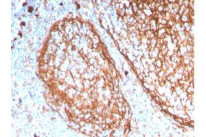 Formalin-fixed, paraffin-embedded human tonsil stained with CD11b Monospecific Mouse Monoclonal Antibody (ITGAM/3338). (CD11b Antikörper  (AA 941-1074))