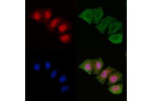 ABIN6256097 and ABIN6267261 staining Hela cells by IF/ICC.