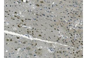 IHC analysis of PCBP2/hnRNP E2 using anti-PCBP2/hnRNP E2 antibody (ABIN7600449). (PCBP2 Antikörper  (AA 197-276))