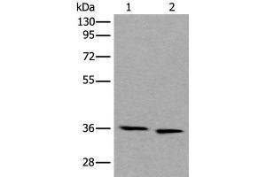 Western blot analysis of 293T and Hela cell lysates using CDC123 Polyclonal Antibody at dilution of 1:550 (CDC123 Antikörper)
