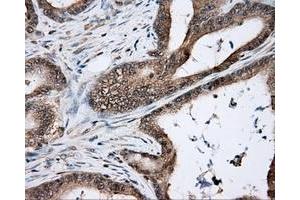 Immunohistochemical staining of paraffin-embedded Kidney tissue using anti-NIT2 mouse monoclonal antibody. (NIT2 Antikörper)