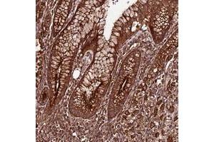 Immunohistochemical staining of human stomach with FAM186A polyclonal antibody  shows strong cytoplasmic positivity in glandular cells. (FAM186A Antikörper)