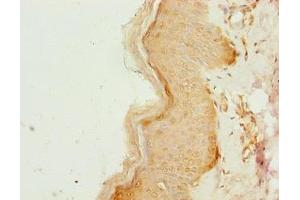 Immunohistochemistry of paraffin-embedded human skin tissue using ABIN7148168 at dilution of 1:100 (CCDC89 Antikörper  (AA 1-200))