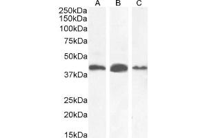 (ABIN2613379) (0. (AMACR Antikörper  (AA 312-326))