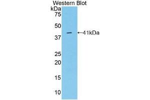 Western blot analysis of the recombinant protein. (Osteocalcin Antikörper  (AA 11-98))