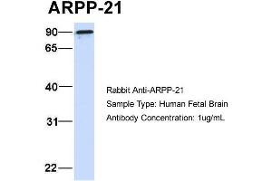 Host:  Rabbit  Target Name:  ARPP-21  Sample Type:  Human Fetal Brain  Antibody Dilution:  1.