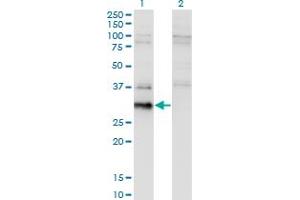 Western Blot analysis of BCL7B expression in transfected 293T cell line by BCL7B monoclonal antibody (M02), clone 4G1. (BCL7B Antikörper  (AA 124-202))
