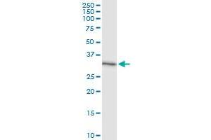 Immunoprecipitation of CCS transfected lysate using anti-CCS MaxPab rabbit polyclonal antibody and Protein A Magnetic Bead , and immunoblotted with CCS purified MaxPab mouse polyclonal antibody (B01P) . (Superoxide dismutase copper chaperone Antikörper  (AA 1-274))