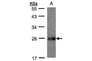 WB Image Sample(30 ug whole cell lysate) A: Raji, 12% SDS PAGE antibody diluted at 1:500 (UQCRFS1 Antikörper)