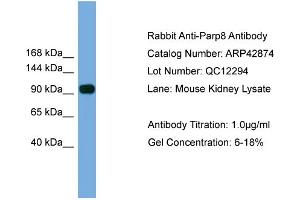 WB Suggested Anti-Parp8 Antibody Titration:  0. (PARP8 Antikörper  (N-Term))