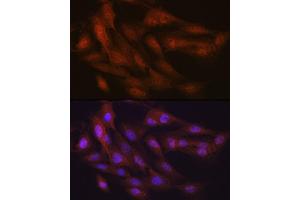 Immunofluorescence analysis of C6 cells using K48-linkage Specific Ubiquitin Rabbit mAb (ABIN1680189, ABIN3017871, ABIN3017872 and ABIN7101530) at dilution of 1:100 (40x lens). (Ubiquitin B Antikörper)