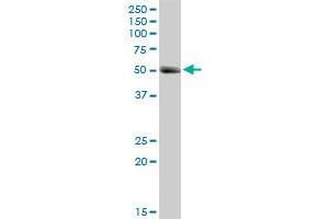 Western Blotting (WB) image for anti-Matrix Metallopeptidase 1 (Interstitial Collagenase) (MMP1) (AA 1-469) antibody (ABIN517954)