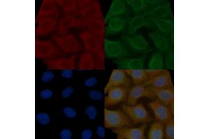 Synapsin I Mouse Monoclonal Antibody staining Hela cells by IF/ICC. (SYN1 Antikörper  (N-Term))