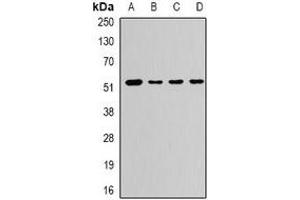 Western blot analysis of CaMK1 gamma expression in PC12 (A), A673 (B), mouse liver (C), rat brain (D) whole cell lysates. (CAMK1G Antikörper)