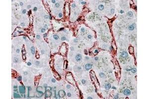 Immunohistochemistry (IHC) image for anti-Fc Fragment of IgG, Low Affinity IIb, Receptor (CD32) (FCGR2B) (C-Term) antibody (ABIN185377)