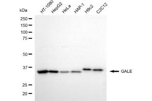 anti-UDP-Galactose-4-Epimerase (GALE) antibody
