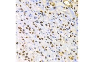 Immunohistochemistry of paraffin-embedded rat kidney using SFN Antibody. (14-3-3 sigma/SFN Antikörper)