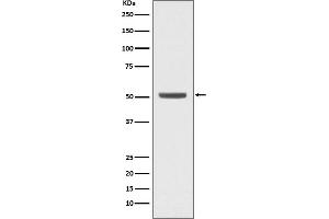 Western blot analysis of E2F2 expression in K562 cell lysate.