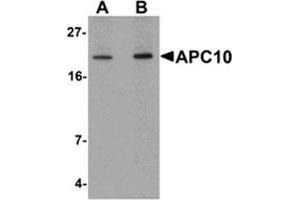 Western blot analysis of APC10 in mouse heart tissue lysate with APC10 antibody at (A) 1 and (B) 2 μg/ml. (ANAPC10 Antikörper  (Center))