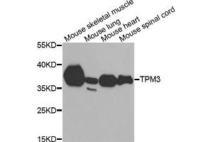 Western blot analysis of extracts of various cell lines, using TPM3 antibody (ABIN6291029) at 1:1000 dilution. (TPM3 Antikörper)