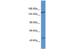 WB Suggested Anti-EIF3A AntibodyTitration: 1. (EIF3A Antikörper  (C-Term))