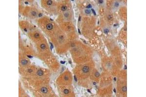 Used in DAB staining on fromalin fixed paraffin-embedded liver tissue (TOR1A Antikörper  (AA 41-333))