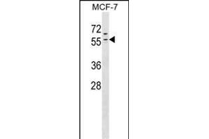 ZN Antibody (N-term) (ABIN1538932 and ABIN2849449) western blot analysis in MCF-7 cell line lysates (35 μg/lane). (ZNF383 Antikörper  (N-Term))