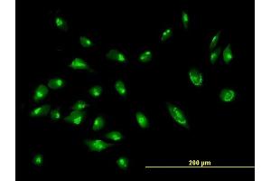 Immunofluorescence of purified MaxPab antibody to GORASP2 on HeLa cell.