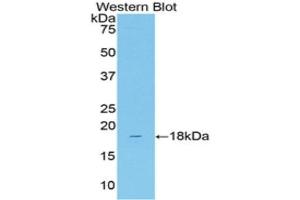 Western Blotting (WB) image for anti-Solute Carrier Family 12 (Sodium/Chloride Transporters), Member 3 (SLC12A3) (AA 3-146) antibody (ABIN2118607) (SLC12A3 Antikörper  (AA 3-146))