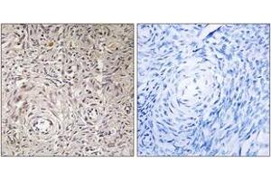 Immunohistochemistry analysis of paraffin-embedded human ovary tissue, using GCNT7 Antibody. (GCNT7 Antikörper  (AA 311-360))